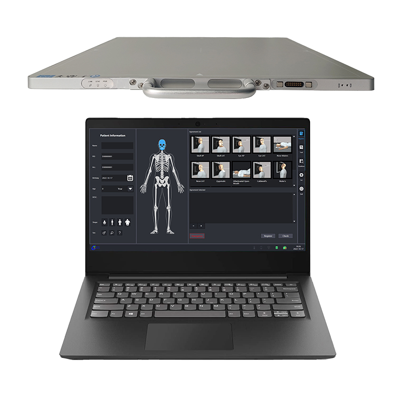 Wireless Digital X-Ray Flat Panel Detector 17x17 FPD for Medical DR and Veterinary X-Ray Machine