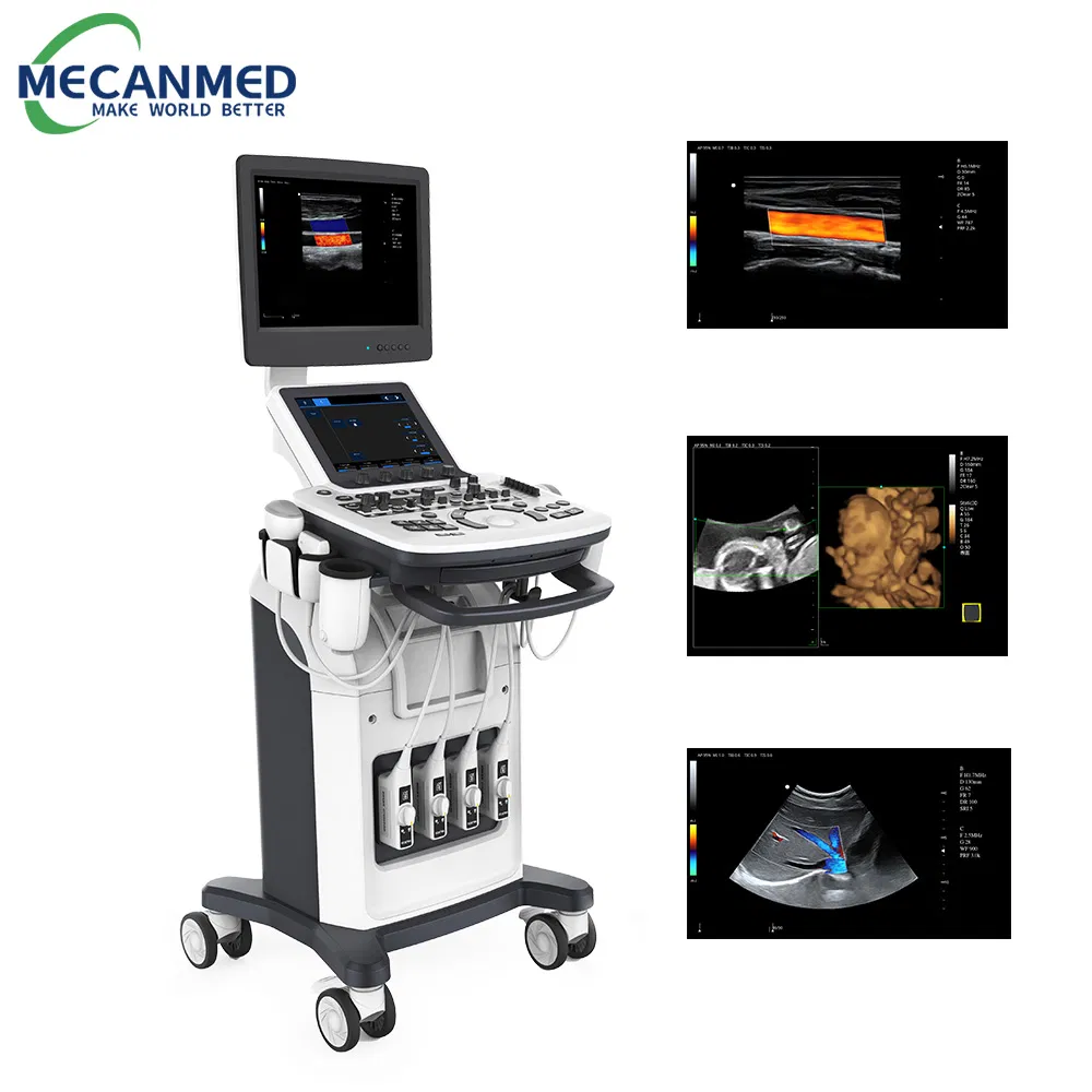 Color Doppler Ultrasound Machine Trolley 3D 4D Medical Ultrasound Scanner for Hospital Clinic