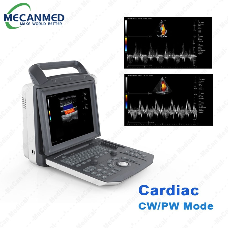Portable Color Doppler Ultrasound Machine for Pregnancy and Cardiac Echocardiography