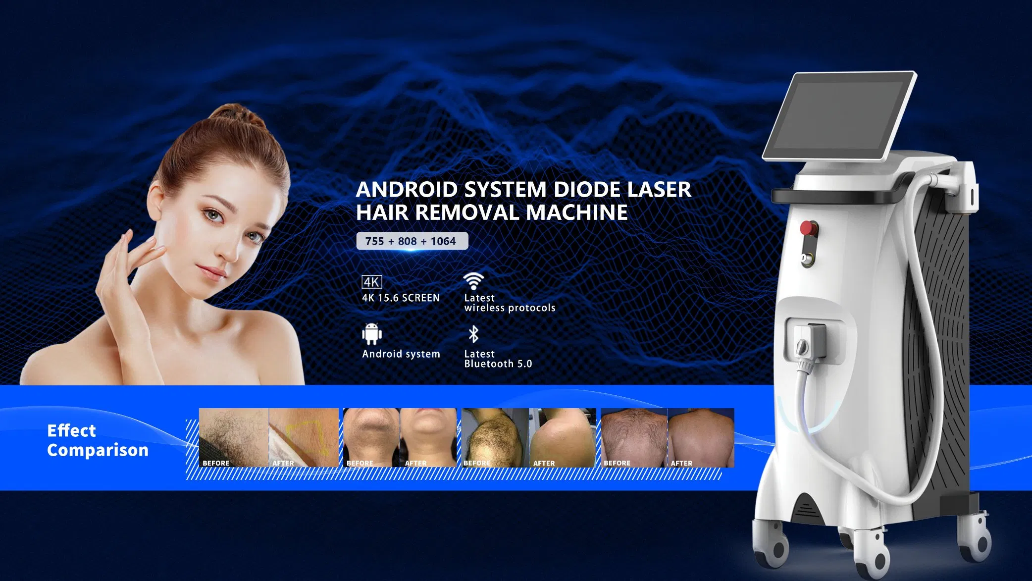 High-Efficiency Hair Removal Diode Machine with Skin Protection