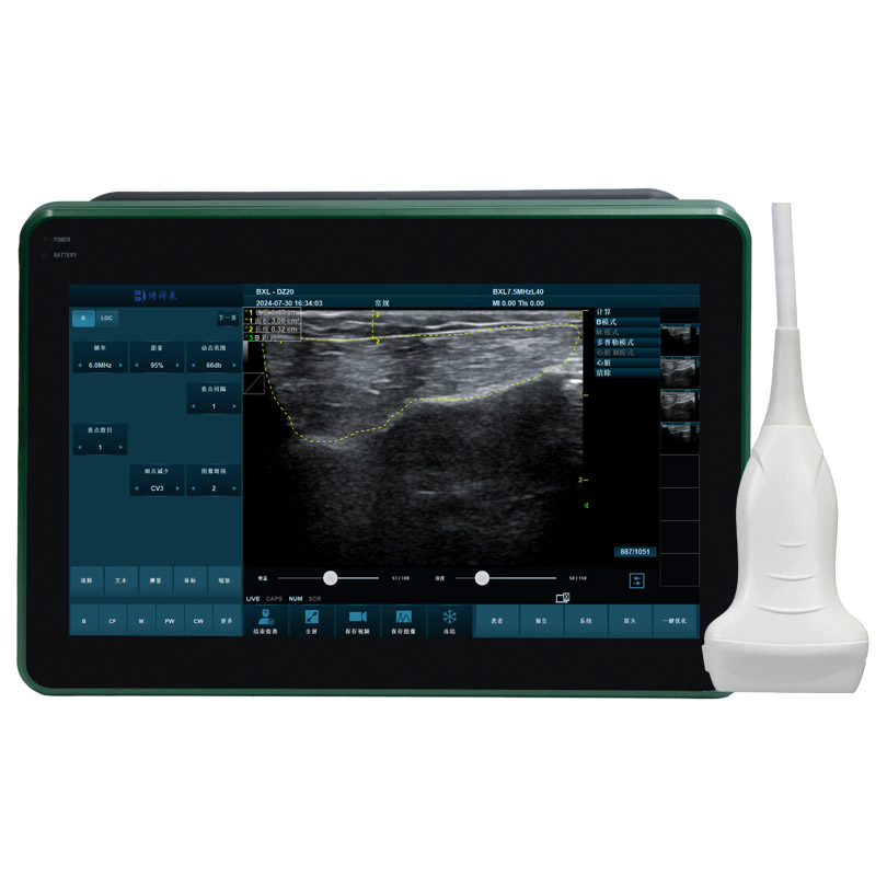Bxl-Dz20 Horse Equine Tendon Measurement Veterinary Ultrasound Color Doppler Imaging Machine