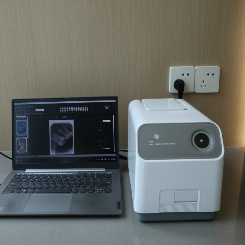 Macchina portatile per raggi X dentali, sistema di imaging digitale intraorale a raggi X, scanner a piastra di fosforo PSP, unità ad alta definizione