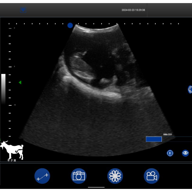 Bxl-S101 Wireless Portable Vet Veterinary Ultrasound Machine Scanner for Goat Sheep Pigs in Vitro Detect