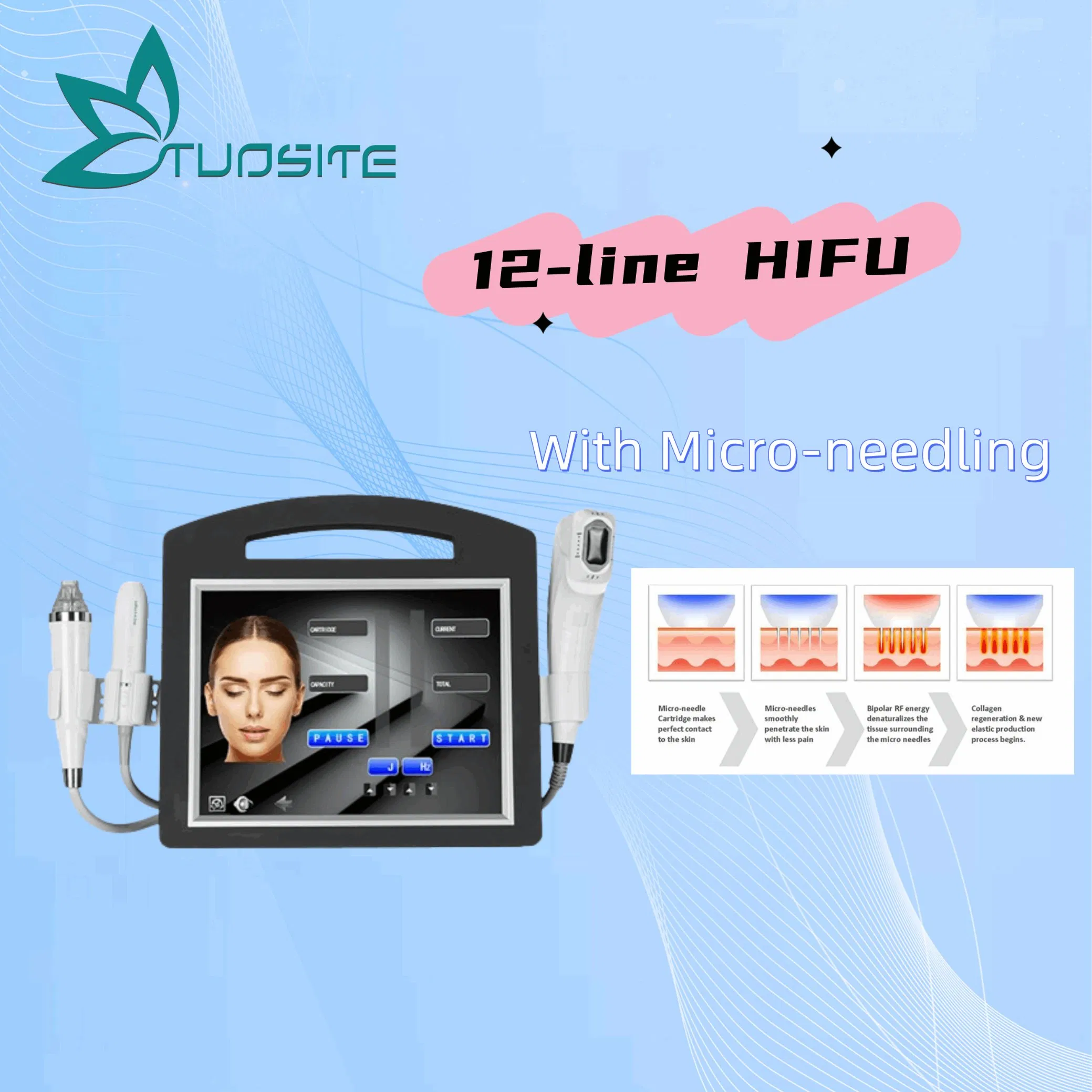 Hifu-Gerät mit RF zur Gesichtsfettreduktion